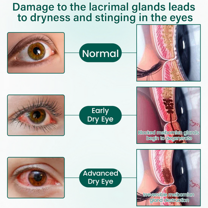 magicalccorners® OptiClear Nano Eye Roller Serum