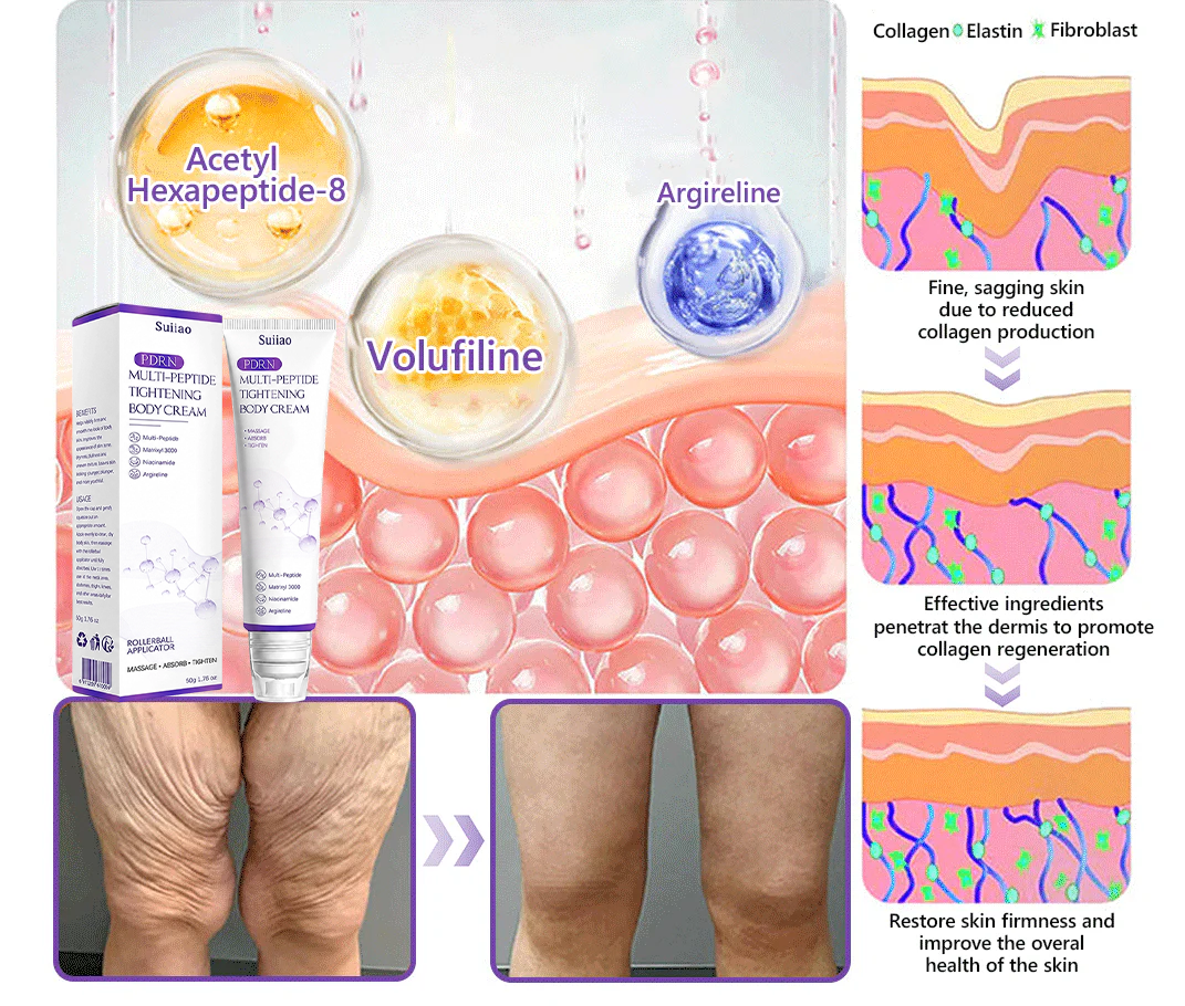 🦩Suiiao® Multi-Peptide Body Massager & Cream — Anti-aging, moisturizing, firming and lifting, skin barrier repair, skin tone evening, acne-prone skin care, blemish, wart, and mole reduction, as well as psoriasis symptom relief