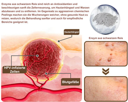 Natravor® Black Rice Skin Repair Essence Cream ⚕️ FDA Certified (Removes warts and skin growths, improves keratin buildup and seborrheic dermatitis, follicular keratosis, age spots, and bruising)
