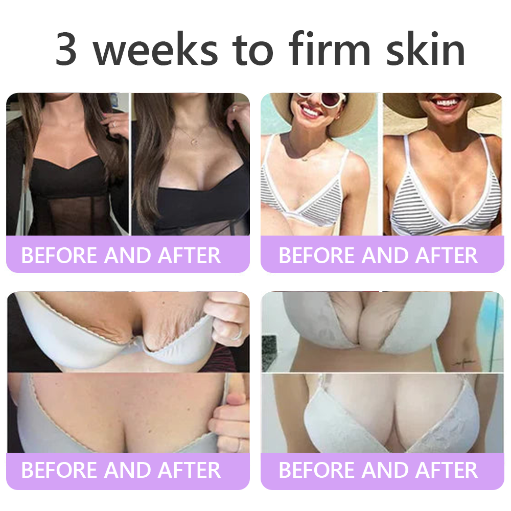 🦩Suiiao® Multi-Peptide Body Massager & Cream — Anti-aging, moisturizing, firming and lifting, skin barrier repair, skin tone evening, acne-prone skin care, blemish, wart, and mole reduction, as well as psoriasis symptom relief