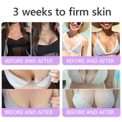 🦩Suiiao® Multi-Peptide Body Massager & Cream — Anti-aging, moisturizing, firming and lifting, skin barrier repair, skin tone evening, acne-prone skin care, blemish, wart, and mole reduction, as well as psoriasis symptom relief