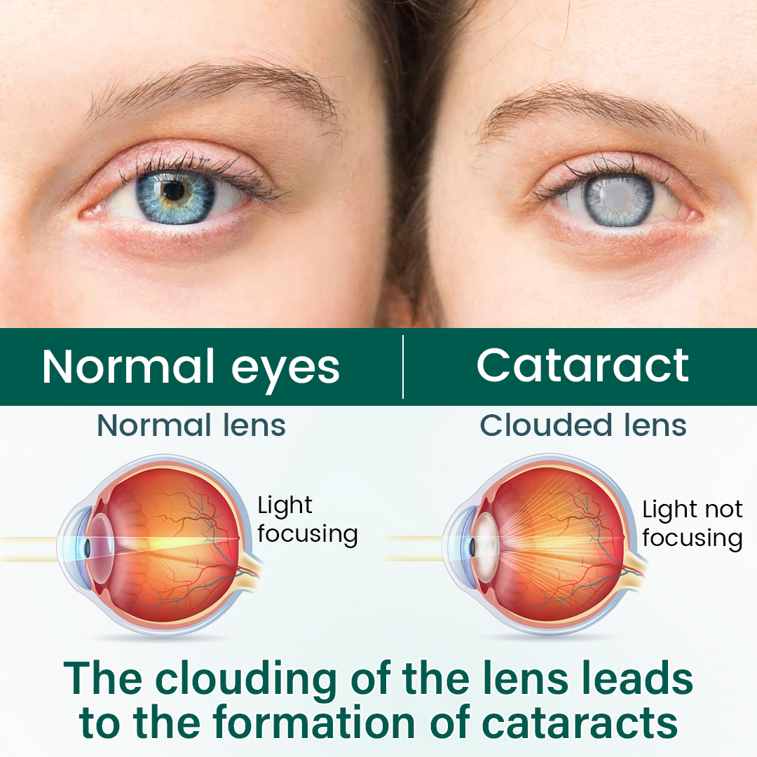 magicalccorners® OptiClear Nano Eye Roller Serum
