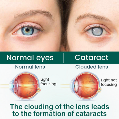 magicalccorners® OptiClear Nano Eye Roller Serum