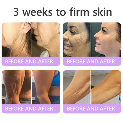 🦩Suiiao® Multi-Peptide Body Massager & Cream — Anti-aging, moisturizing, firming and lifting, skin barrier repair, skin tone evening, acne-prone skin care, blemish, wart, and mole reduction, as well as psoriasis symptom relief