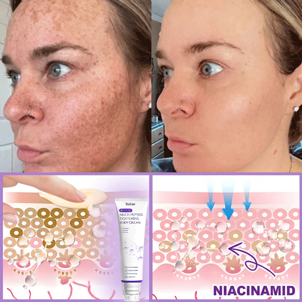 🦩Suiiao® Multi-Peptide Body Massager & Cream — Anti-aging, moisturizing, firming and lifting, skin barrier repair, skin tone evening, acne-prone skin care, blemish, wart, and mole reduction, as well as psoriasis symptom relief
