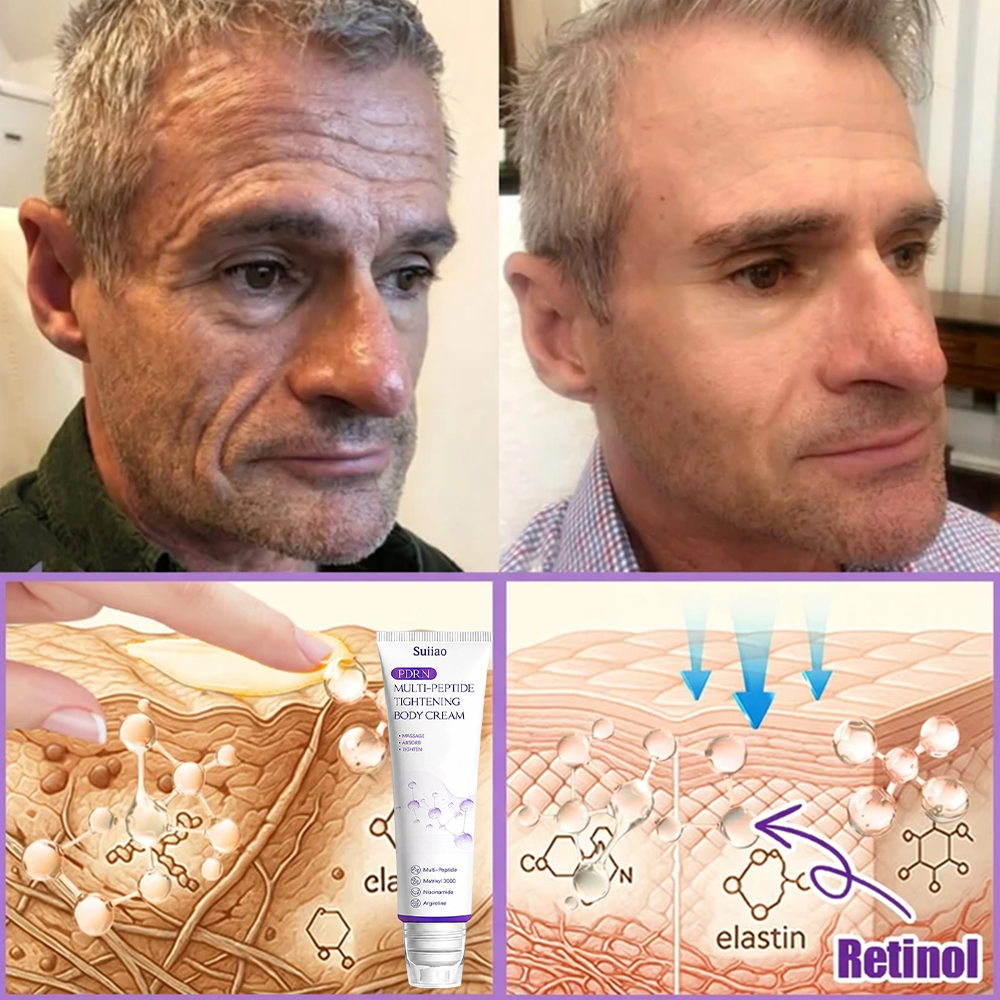 🦩Suiiao® Multi-Peptide Body Massager & Cream — Anti-aging, moisturizing, firming and lifting, skin barrier repair, skin tone evening, acne-prone skin care, blemish, wart, and mole reduction, as well as psoriasis symptom relief