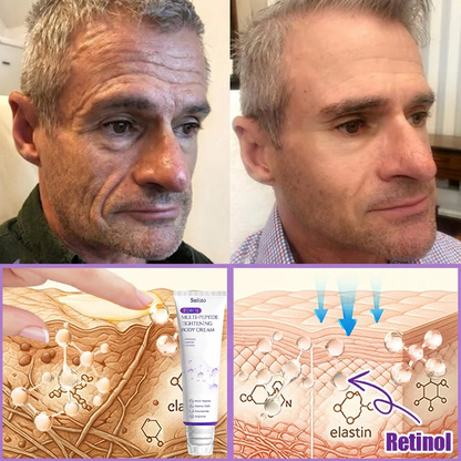 🦩Suiiao® Multi-Peptide Body Massager & Cream — Anti-aging, moisturizing, firming and lifting, skin barrier repair, skin tone evening, acne-prone skin care, blemish, wart, and mole reduction, as well as psoriasis symptom relief