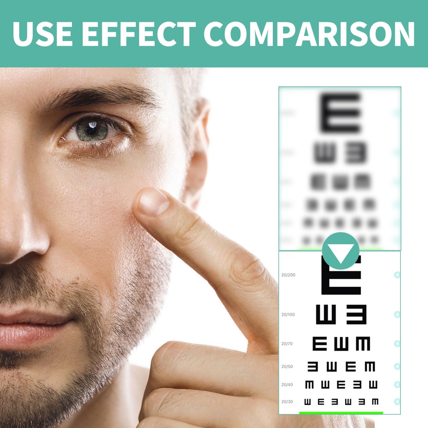 magicalccorners® OptiClear Nano Eye Roller Serum